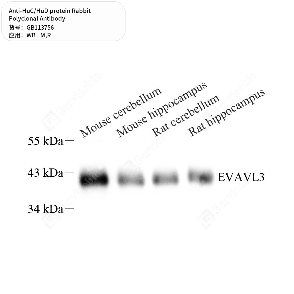 Антитела первичные, поликлональные кролика к HuC/HuD protein крысы, мыши, 100 мкл