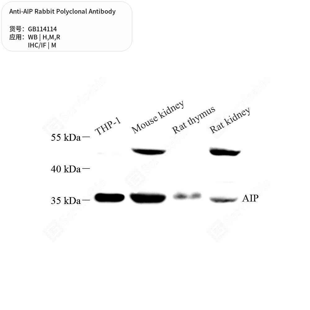 Антитела первичные, поликлональные кролика к AIP крысы, мыши, человека, 50 мкл