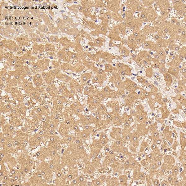 Антитела первичные, поликлональные, Glycogenin 2, 100 мкл