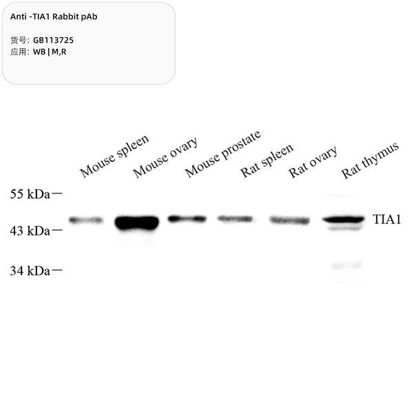 Антитела первичные, поликлональные, TIA1, 100 мкл