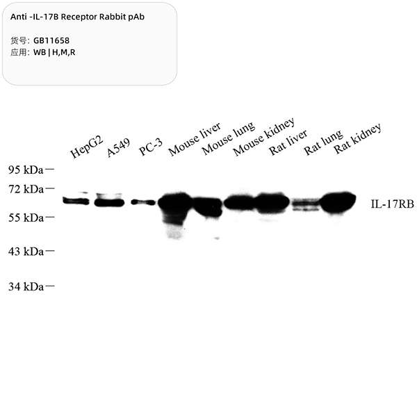 Антитела первичные, поликлональные, IL-17B Receptor, 100 мкл