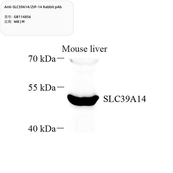 Антитела первичные, поликлональные, SLC39A14/ZIP-14, 100 мкл