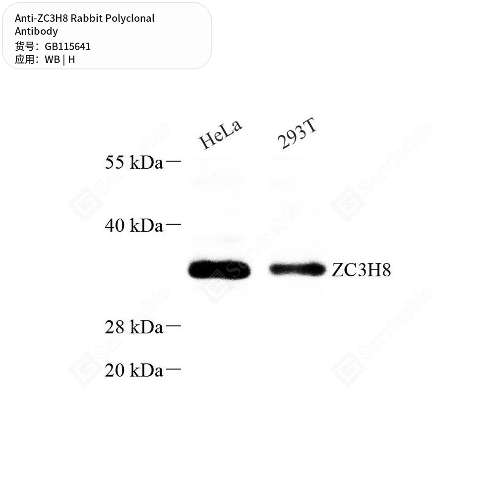 Антитела первичные, поликлональные кролика к ZC3H8 человека, 100 мкл