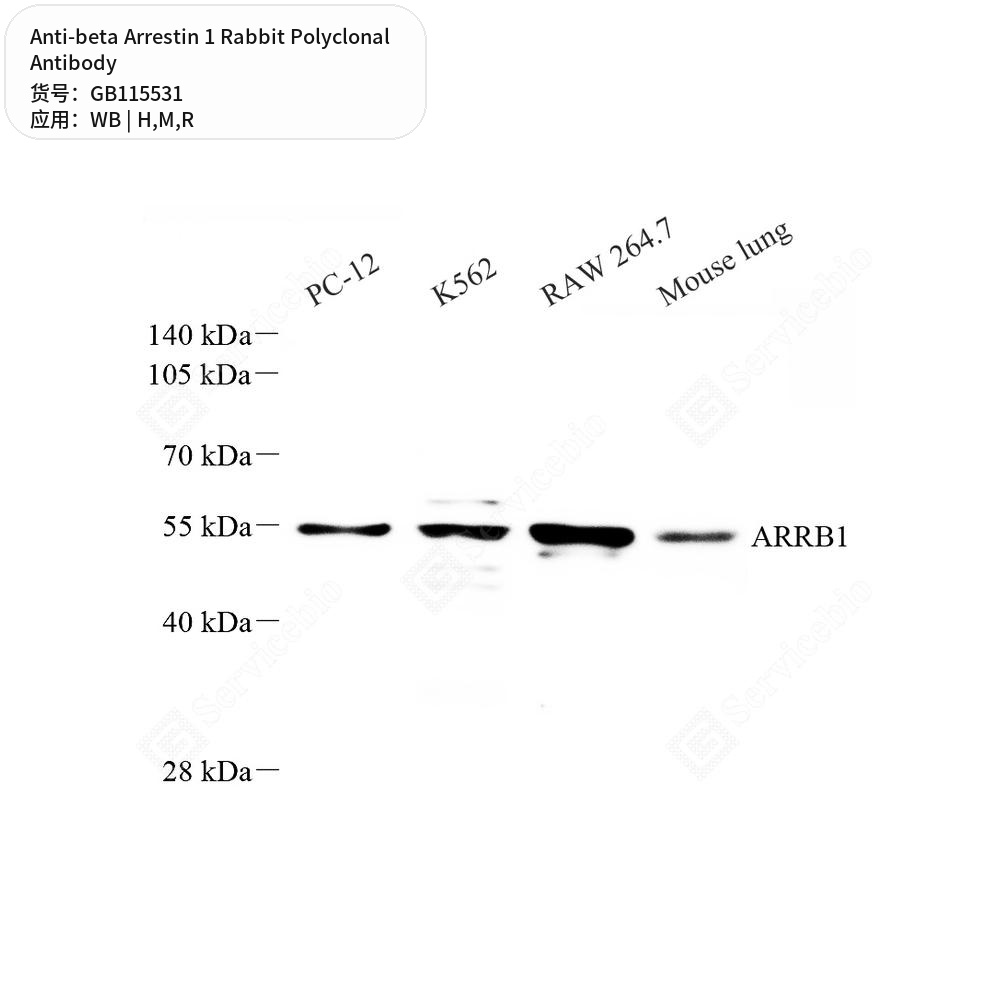 Антитела первичные, поликлональные кролика к beta Arrestin 1 крысы, мыши, человека, 50 мкл