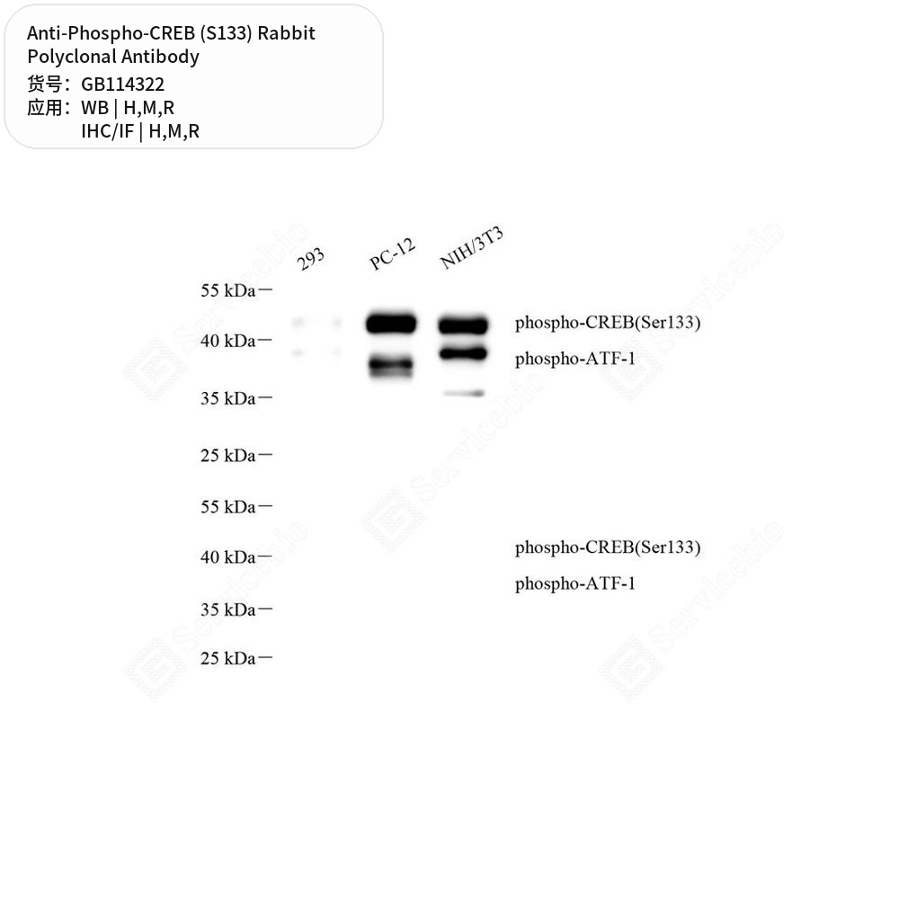 Антитела первичные, поликлональные кролика к Phospho-CREB (S133) крысы, мыши, человека, 50 мкл