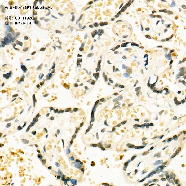 Антитела первичные, поликлональные, Dlx4/BP1, 100 мкл