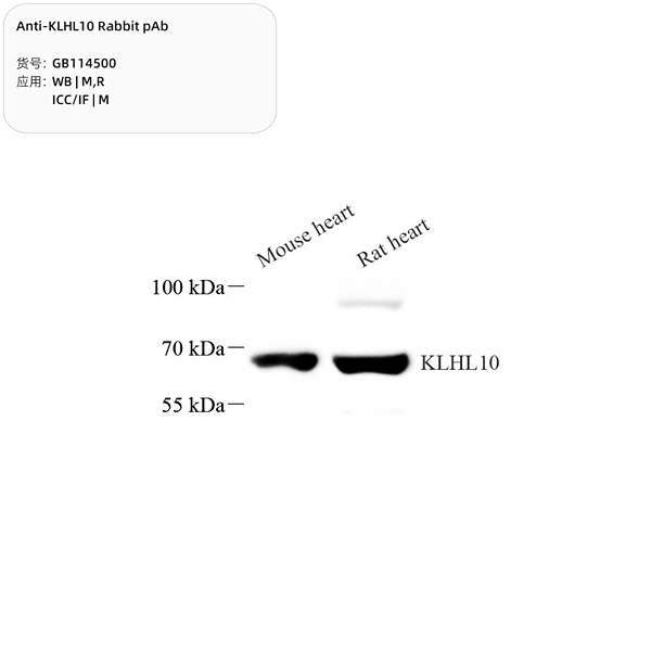 Антитела первичные, поликлональные, KLHL10, 100 мкл