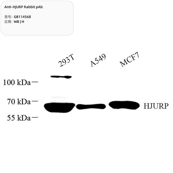 Антитела первичные, поликлональные, HJURP, 100 мкл