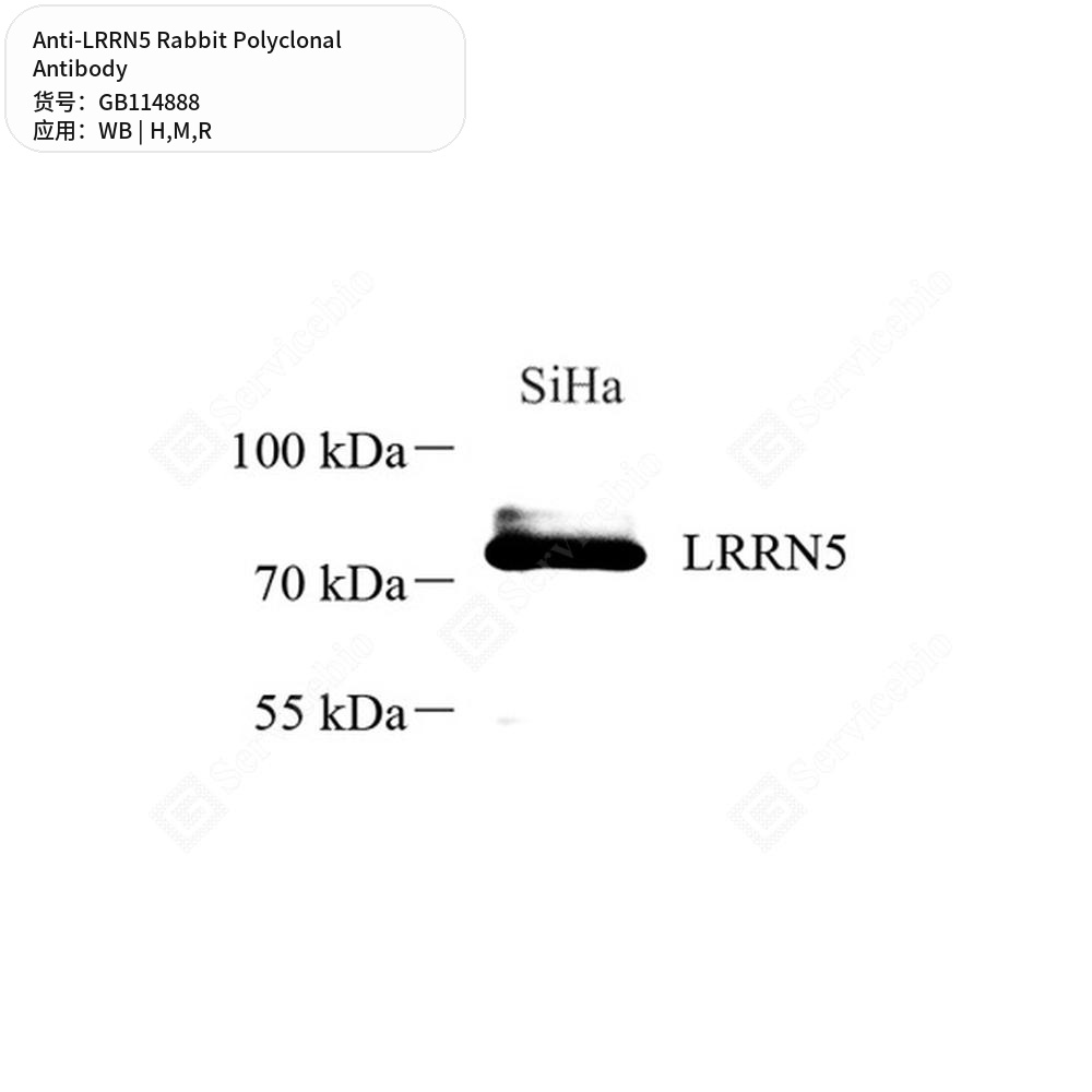 Антитела первичные, поликлональные кролика к LRRN5 крысы, мыши, человека, 100 мкл