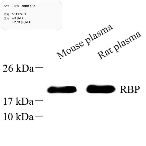 Антитела первичные, поликлональные, RBP4, 100 мкл