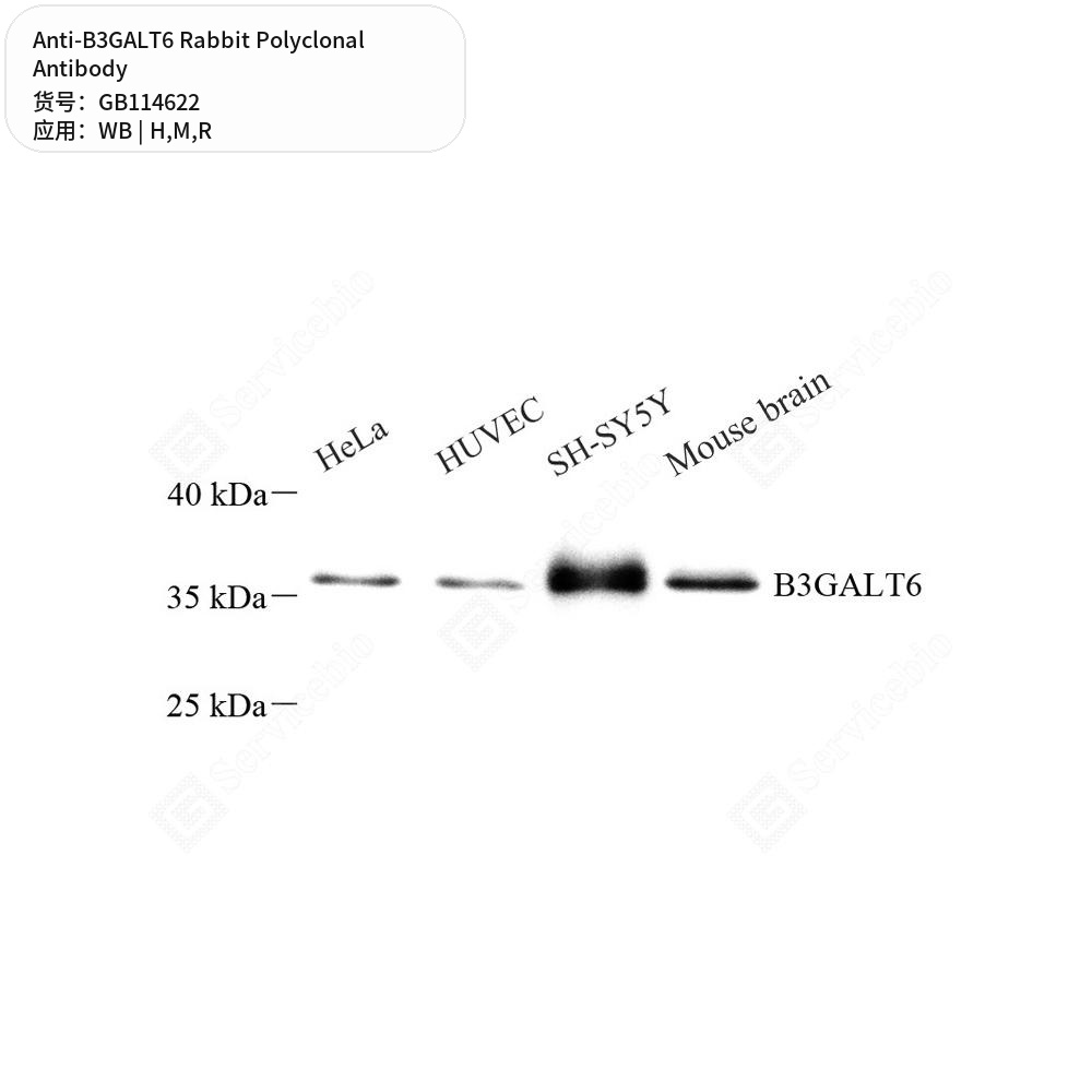 Антитела первичные, поликлональные кролика к B3GALT6 крысы, мыши, человека, 100 мкл