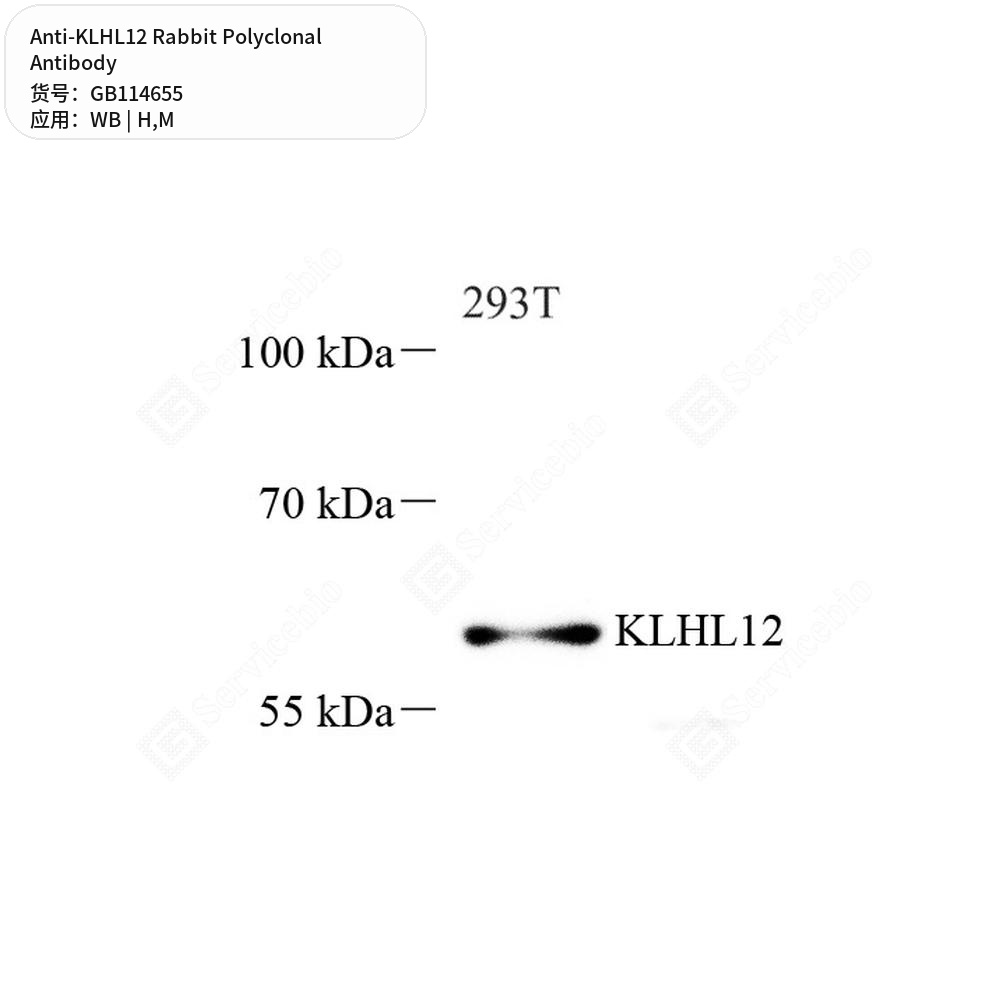 Антитела первичные, поликлональные кролика к KLHL12 мыши, человека, 100 мкл
