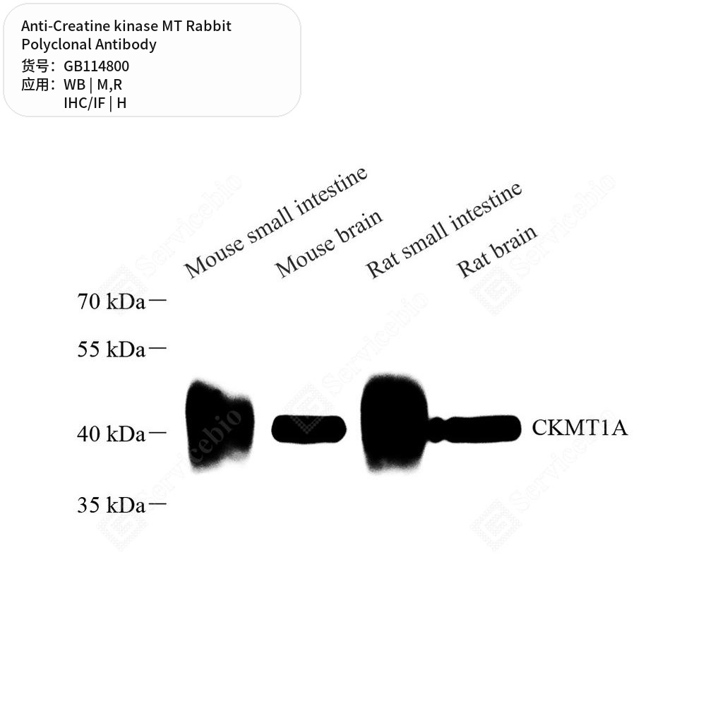 Антитела первичные, поликлональные кролика к Creatine kinase MT крысы, мыши, человека, 50 мкл
