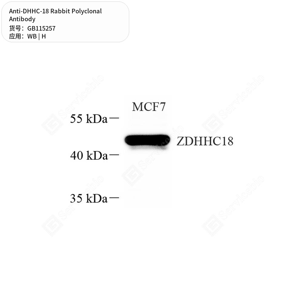 Антитела первичные, поликлональные кролика к DHHC-18 человека, 100 мкл