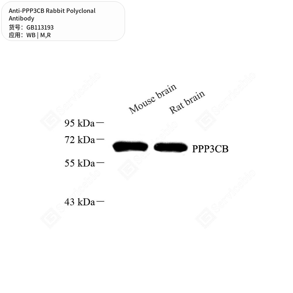 Антитела первичные, поликлональные кролика к PPP3CB крысы, мыши, 50 мкл