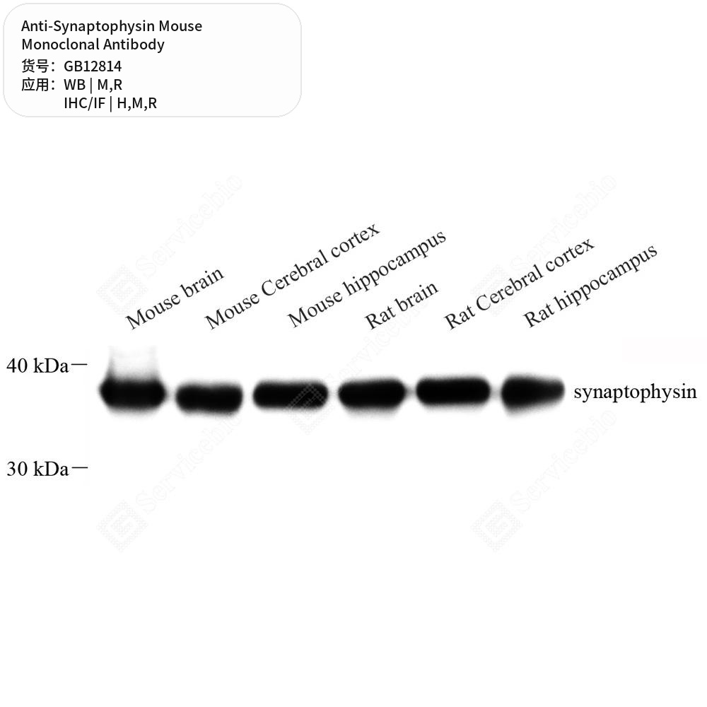 Антитела первичные, моноклональные мыши к Synaptophysin крысы, мыши, человека, 50 мкл