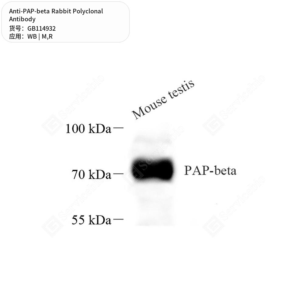 Антитела первичные, поликлональные кролика к PAP-beta крысы, мыши, 100 мкл