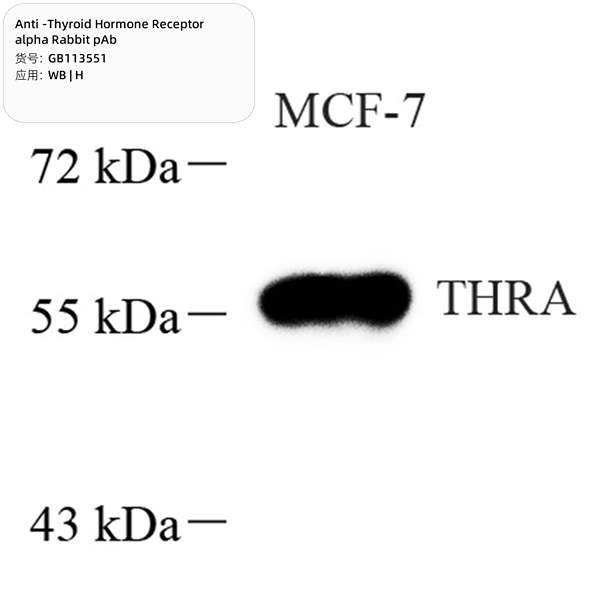 Антитела первичные, поликлональные, Thyroid Hormone Receptor alpha, 100 мкл