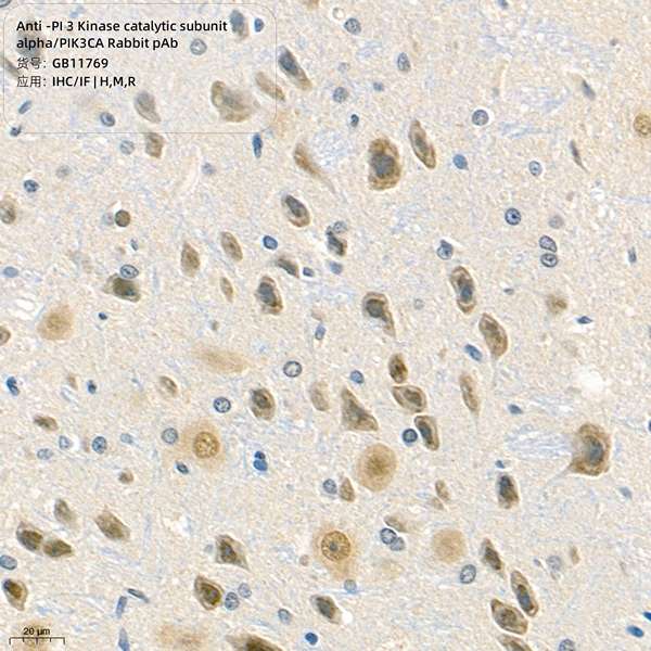 Антитела первичные, поликлональные, PI 3 Kinase catalytic subunit alpha/PIK3CA, 100 мкл