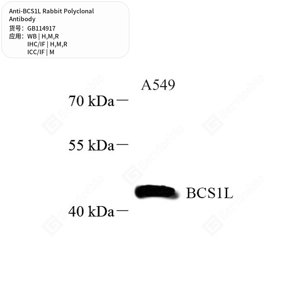 Антитела первичные, поликлональные кролика к BCS1L крысы, мыши, человека, 50 мкл