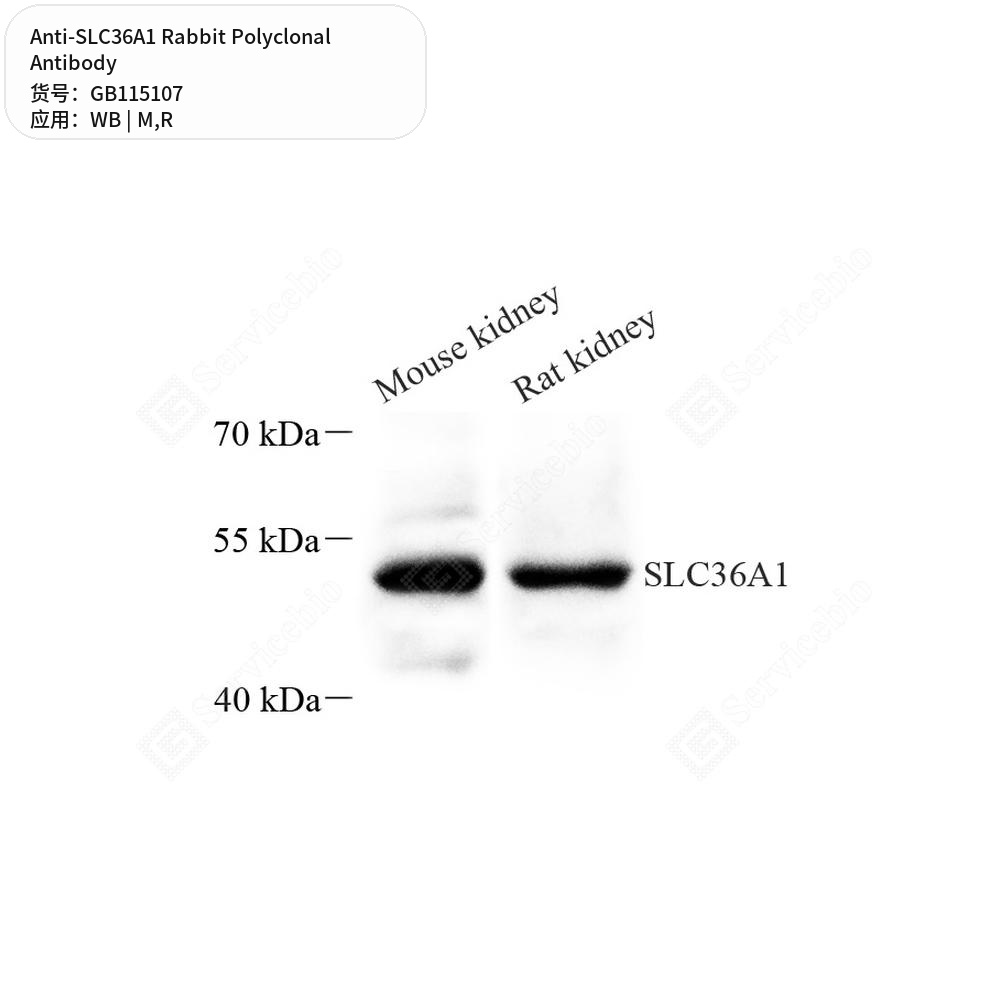 Антитела первичные, поликлональные кролика к SLC36A1 крысы, мыши, 100 мкл