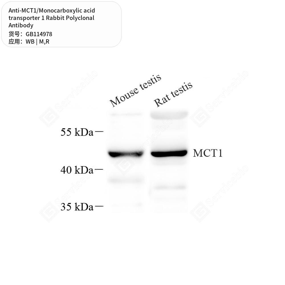 Антитела первичные, поликл. кролика к MCT1/Monocarboxylic acid transporter 1 крысы, мыши, 50 мкл