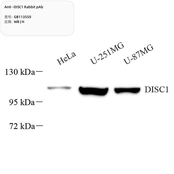 Антитела первичные, поликлональные, DISC1, 100 мкл