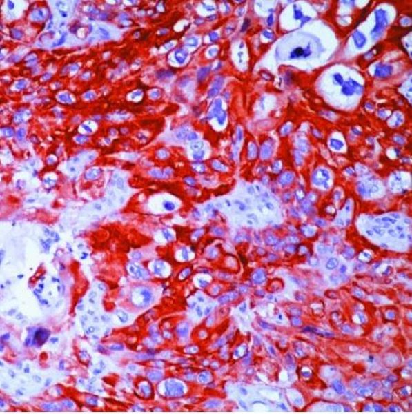 Антитела первичные, моноклональные Cytokeratin 14, 500 мкл