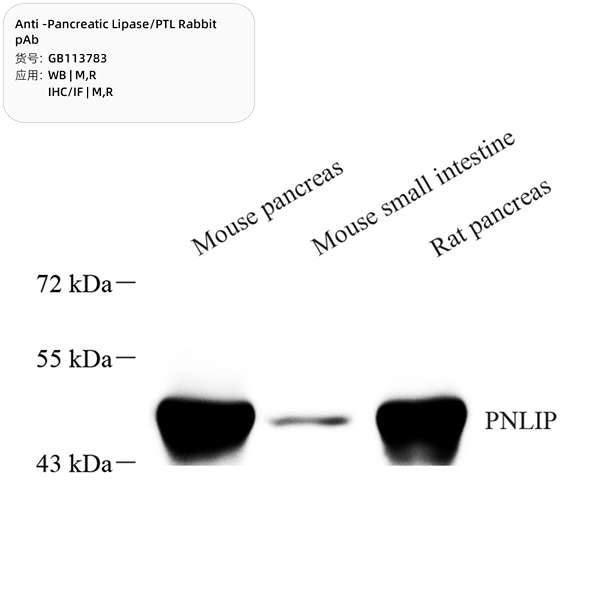 Антитела первичные, поликлональные, Pancreatic Lipase/PTL, 100 мкл
