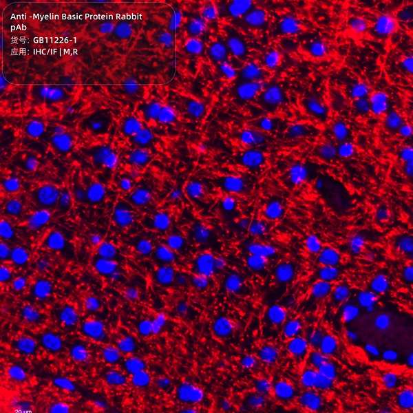 Антитела первичные, поликлональные, Myelin Basic Protein, 100 мкл