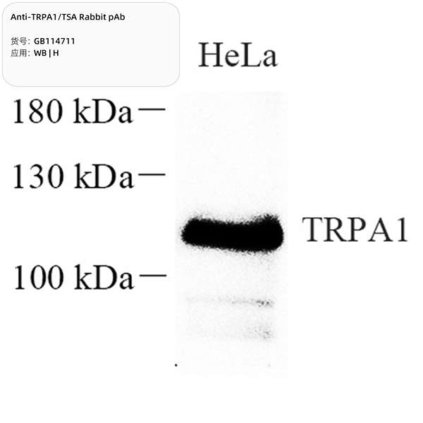 Антитела первичные, поликлональные, TRPA1/TSA, 100 мкл