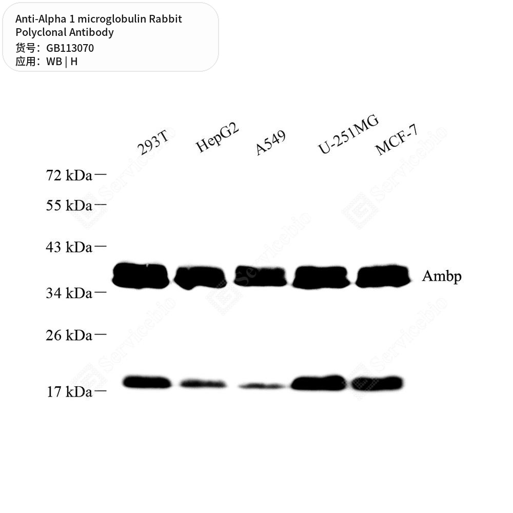 Антитела первичные, поликлональные кролика к Alpha 1 microglobulin человека, 100 мкл