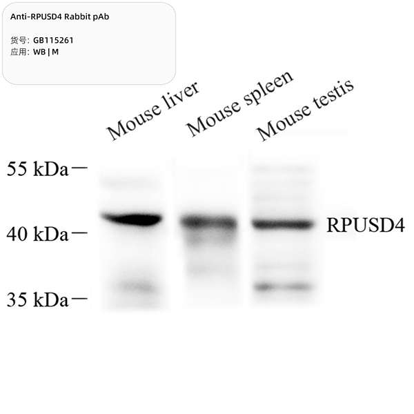 Антитела первичные, поликлональные, RPUSD4, 100 мкл