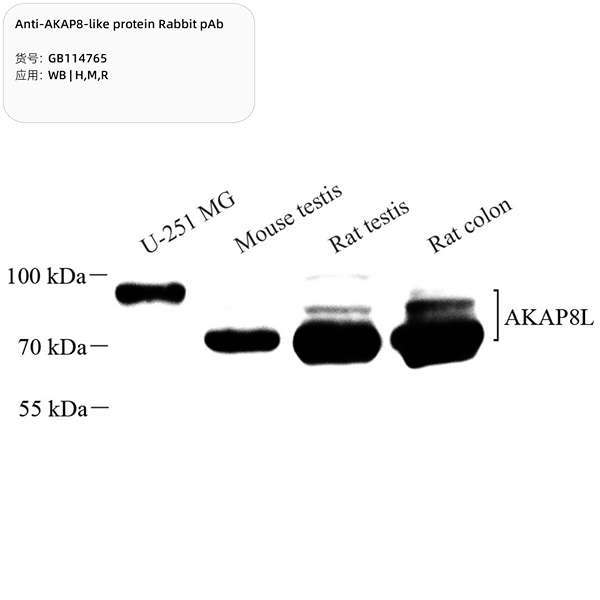 Антитела первичные, поликлональные, AKAP8-like protein, 100 мкл