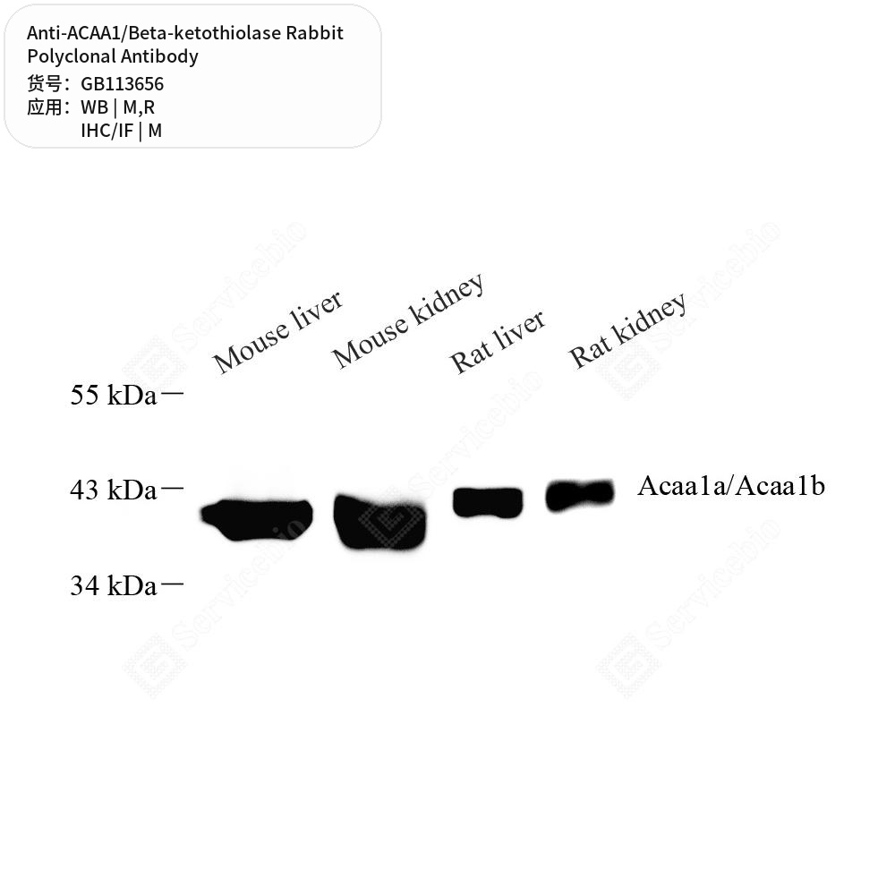 Антитела первичные, поликлональные кролика к ACAA1/Beta-ketothiolase крысы, мыши, 100 мкл