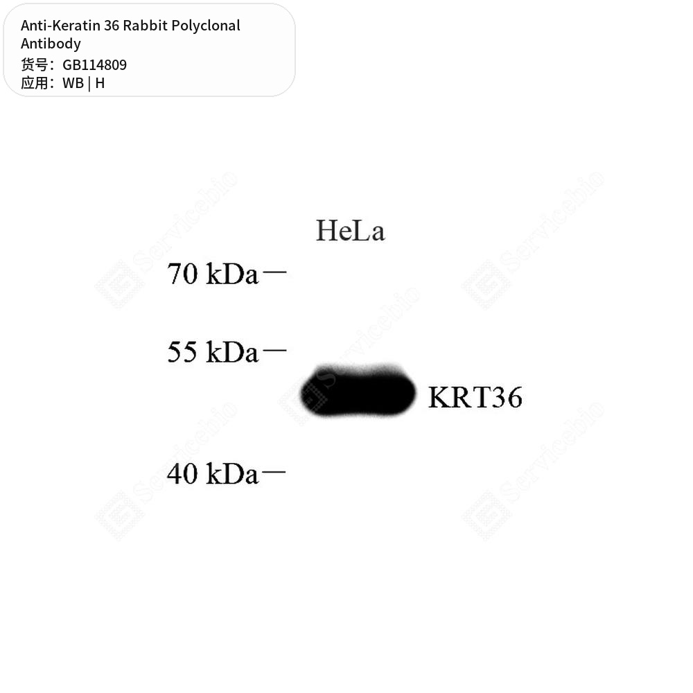 Антитела первичные, поликлональные кролика к Keratin 36 человека, 50 мкл