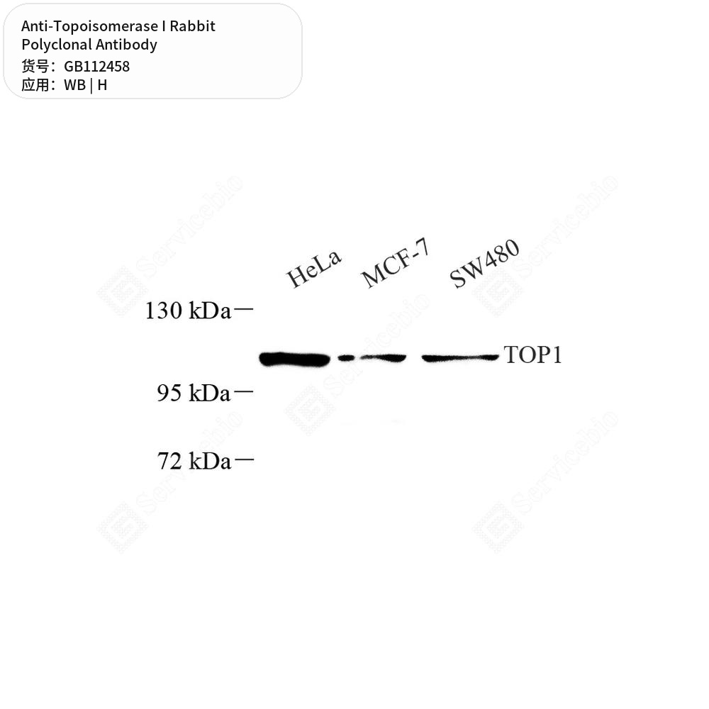 Антитела первичные, поликлональные кролика к Topoisomerase I человека, 100 мкл