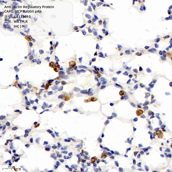 Антитела первичные, поликлональные, Actin Regulatory Protein CAPG/MCP, 100 мкл