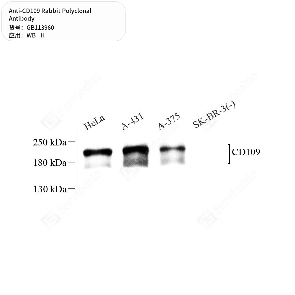 Антитела первичные, поликлональные кролика к CD109 человека, 100 мкл