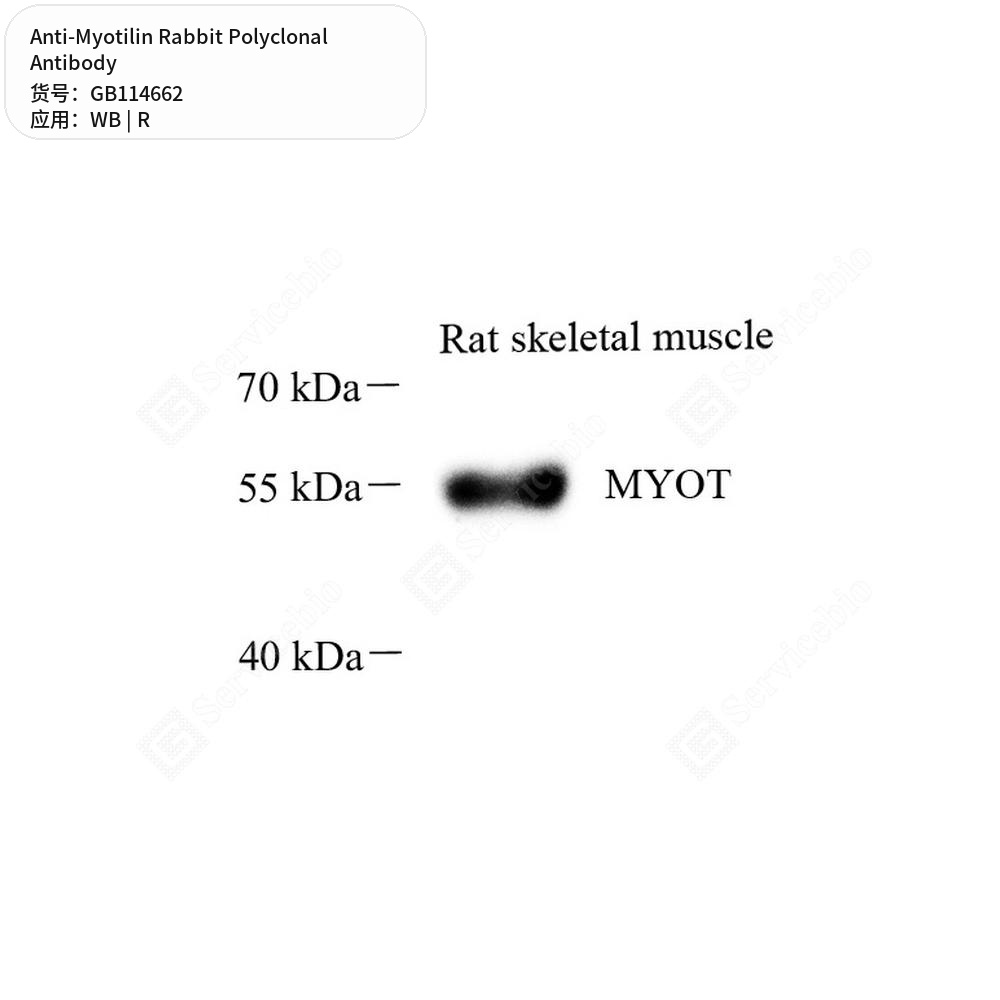 Антитела первичные, поликлональные кролика к Myotilin крысы, 50 мкл