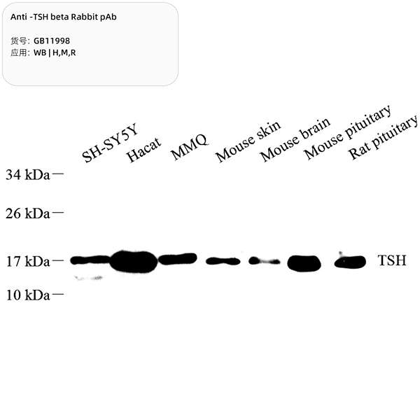 Антитела первичные, поликлональные, TSH beta, 100 мкл