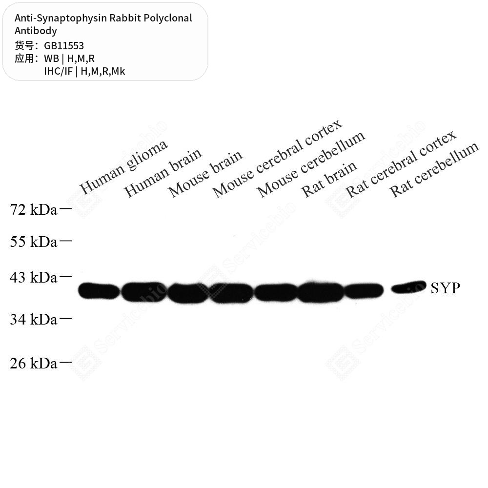 Антитела первичные, поликлональные кролика к Synaptophysin крысы, мыши, обезьяны, человека, 50 мкл