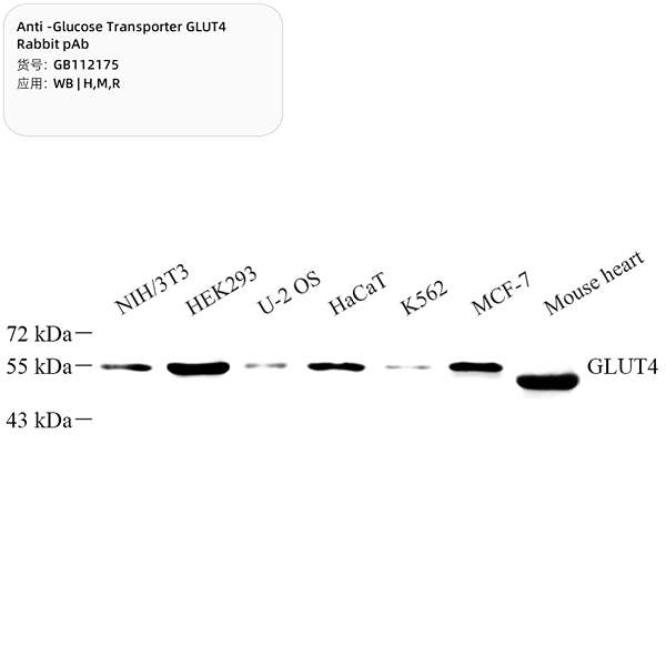 Антитела первичные, поликлональные, Glucose Transporter GLUT4, 100 мкл