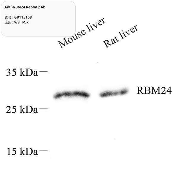 Антитела первичные, поликлональные, RBM24, 100 мкл