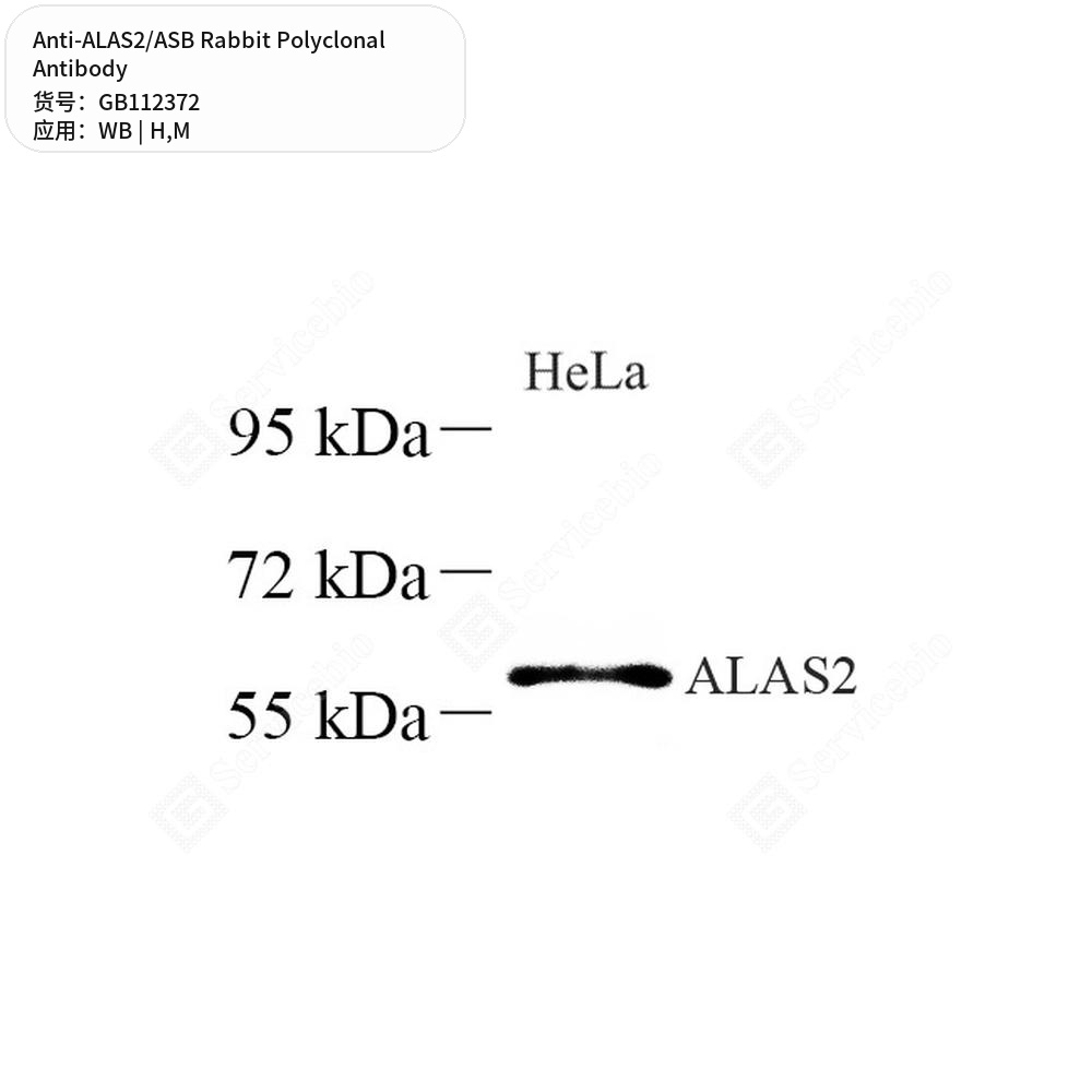 Антитела первичные, поликлональные кролика к ALAS2/ASB мыши, человека, 100 мкл