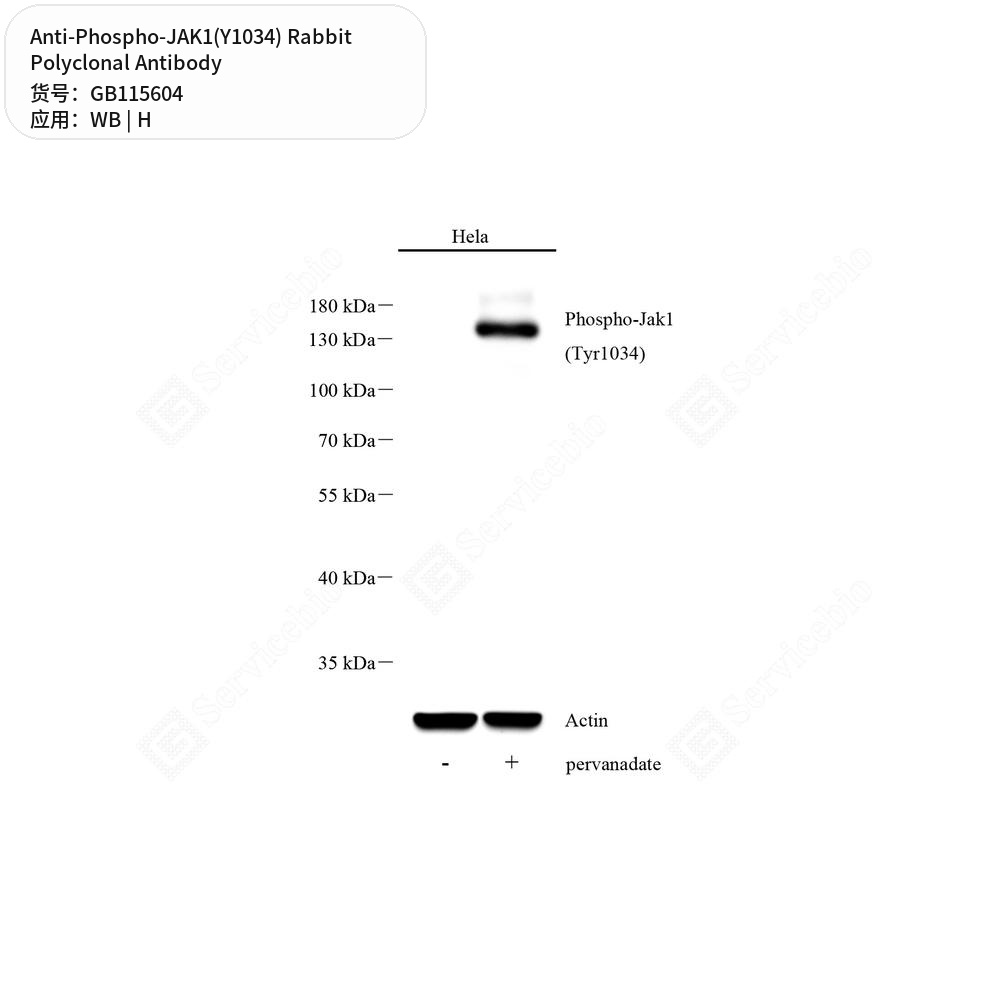 Антитела первичные, поликлональные кролика к Phospho-JAK1(Y1034) человека, 50 мкл
