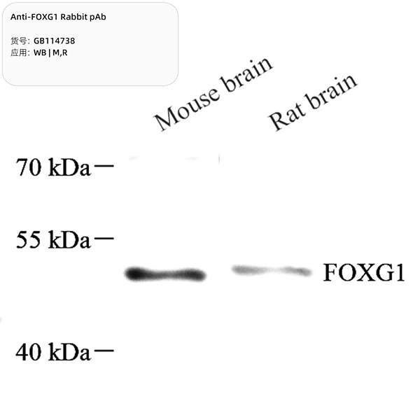 Антитела первичные, поликлональные, FOXG1, 100 мкл