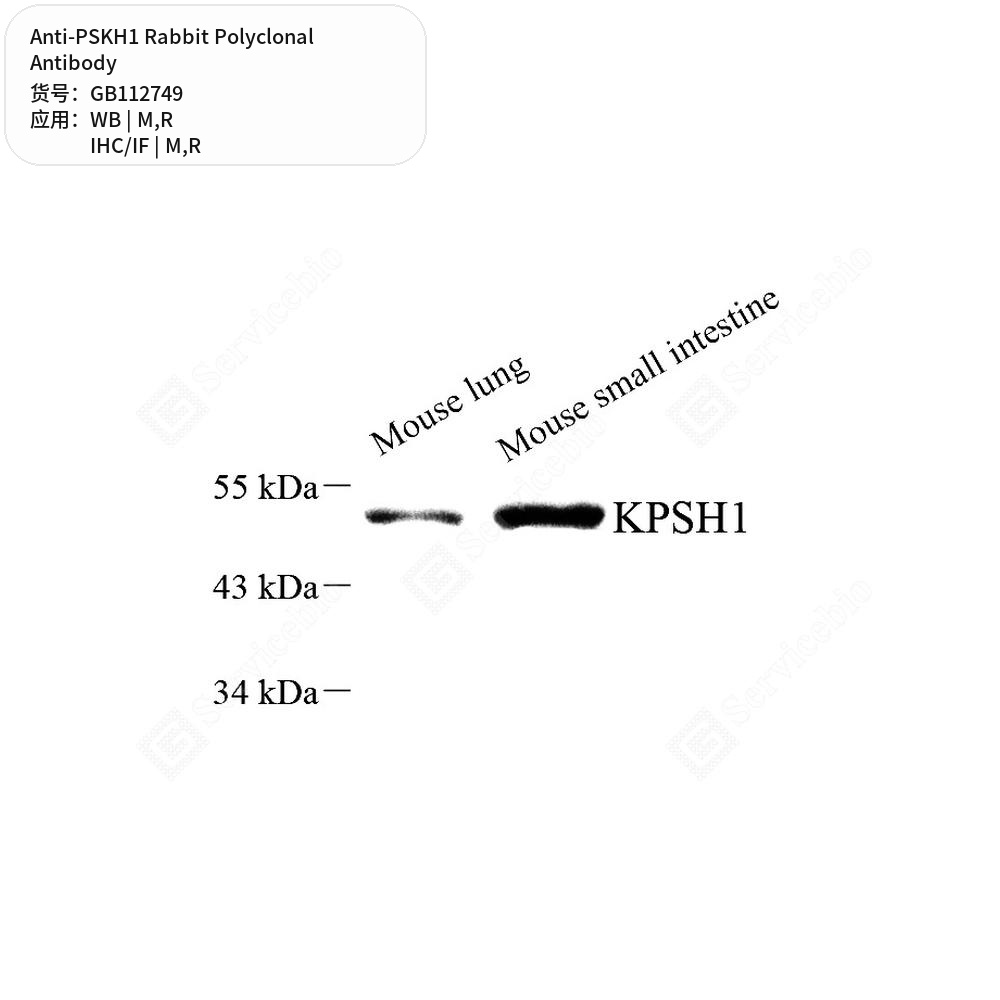 Антитела первичные, поликлональные кролика к PSKH1 крысы, мыши, 50 мкл