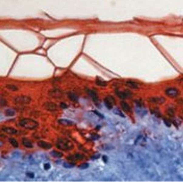 Антитела первичные, моноклональные Cytokeratin 10, 500 мкл