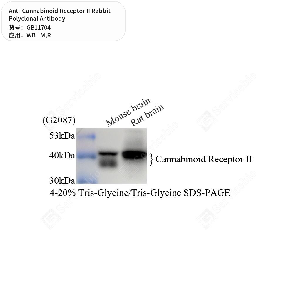 Антитела первичные, поликлональные кролика к Cannabinoid Receptor II крысы, мыши, 50 мкл